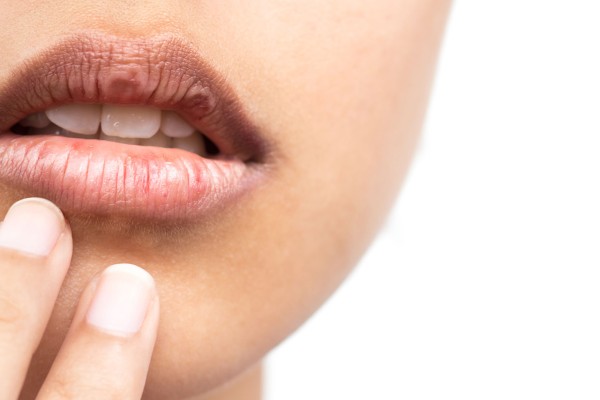 Ağız Kuruluğu Neden Olur?