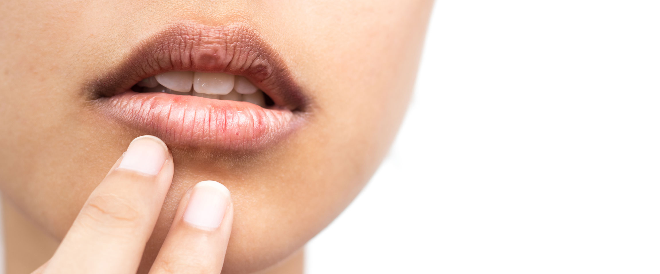 What Causes Dry Mouth?