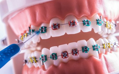 Arayüz Fırçası Nedir? Diş İpi ile Kıyaslaması