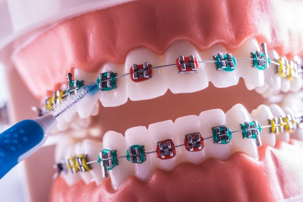 Arayüz Fırçası Nedir? Diş İpi ile Kıyaslaması