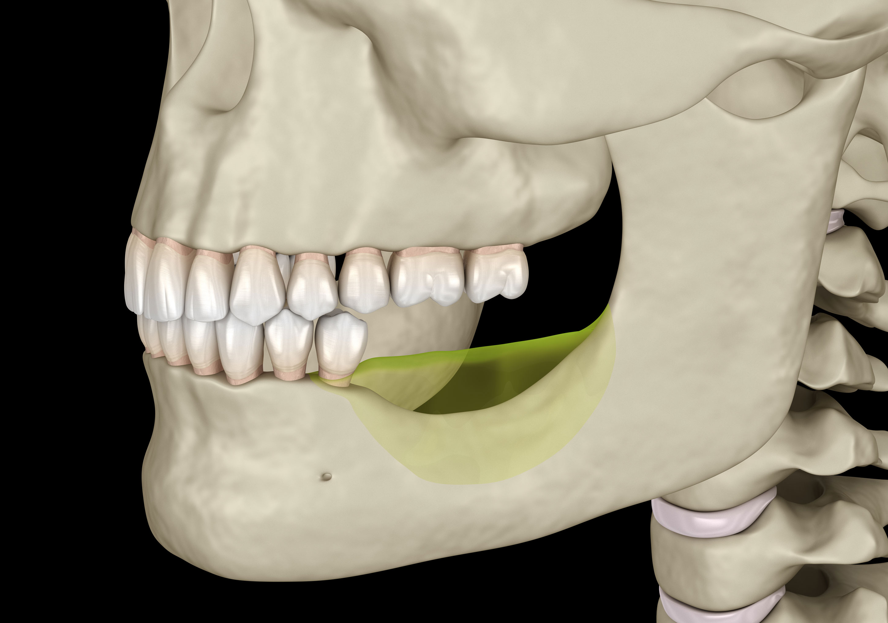 What is Jaw Bone Resorption? What are The Symptoms?