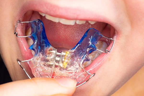 Damaklık Hangi Durumlarda Kullanılır?