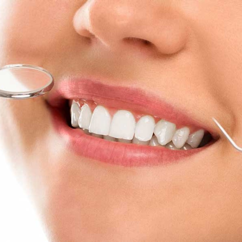 Dental Tedaviler Hakkında Bilmeniz Gerekenler 