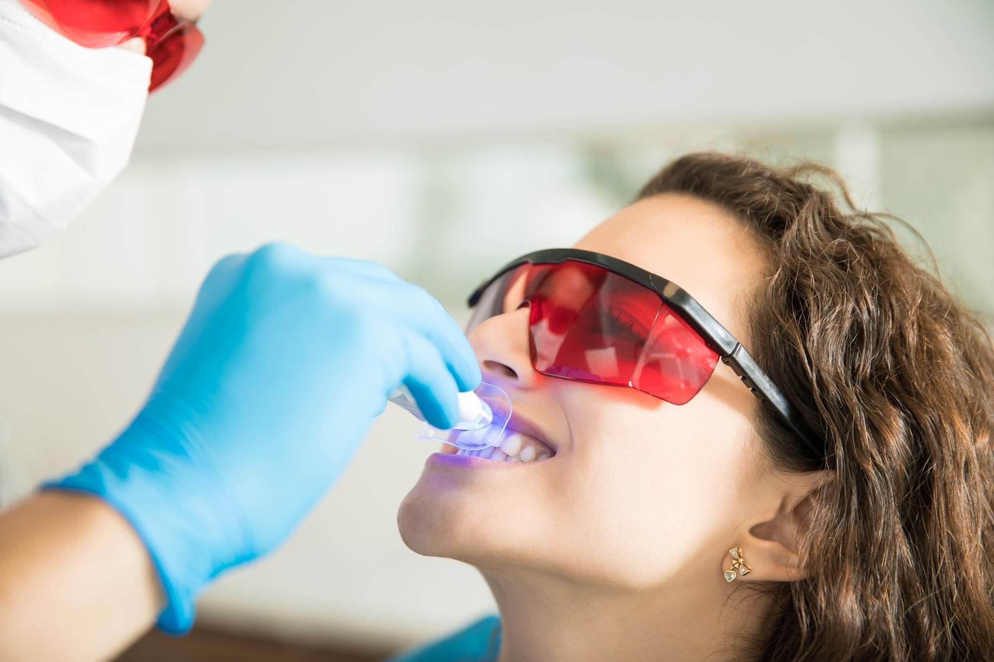 Teeth Whitening: More Effective at Home or in the Clinic?