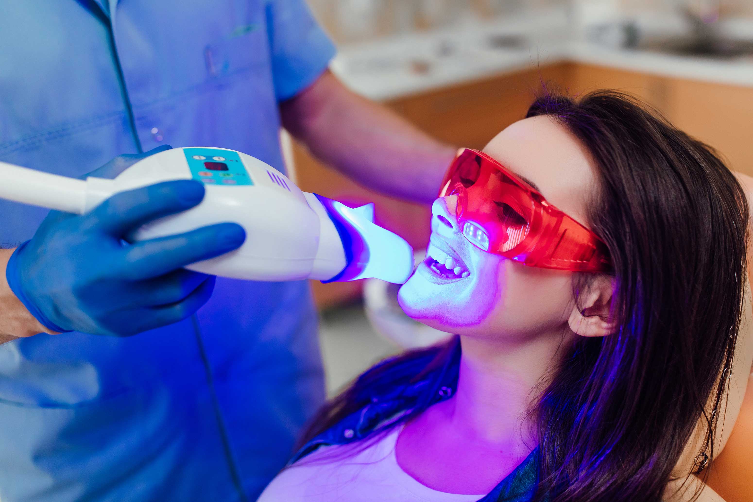 Things to Consider After Teeth Whitening