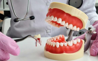 Diş Çekimi Hangi Durumlarda Gerekli Olabilir?