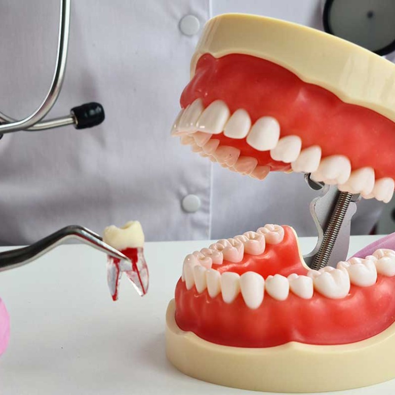 When Might Tooth Extraction Be Necessary?