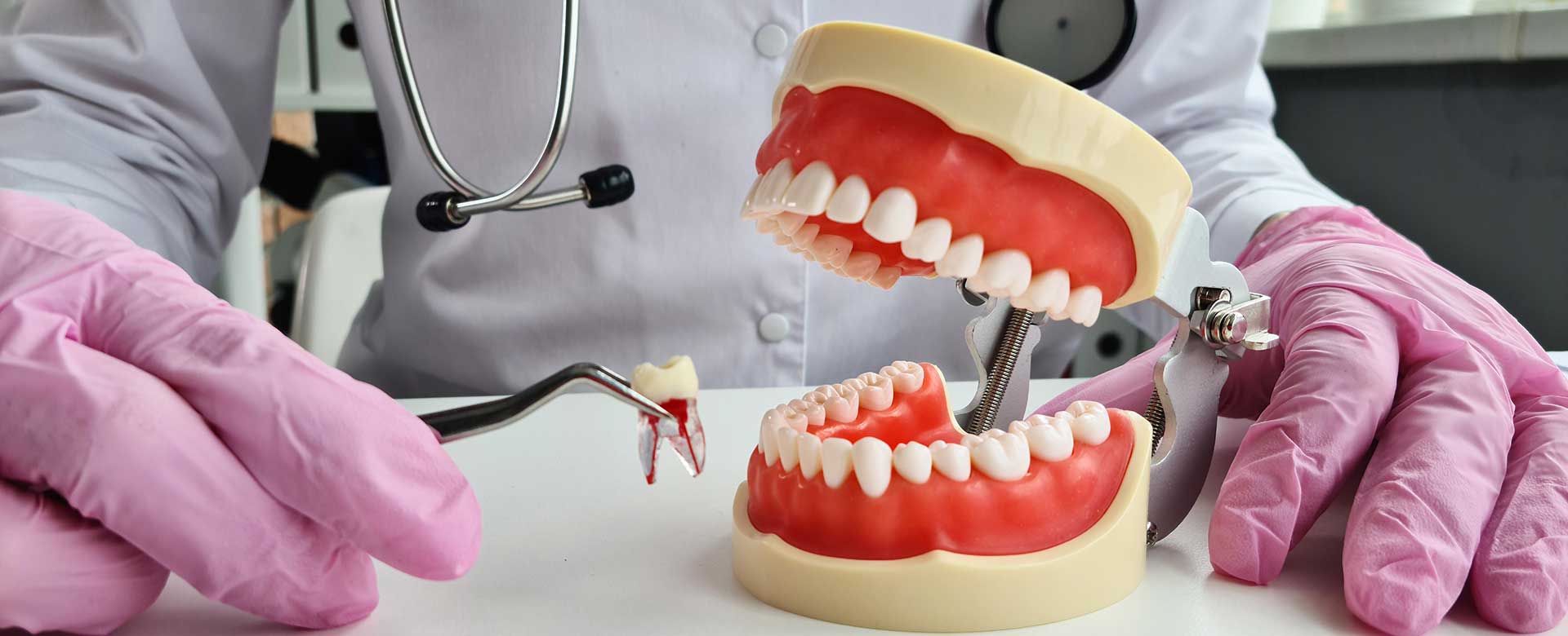 When Might Tooth Extraction Be Necessary?