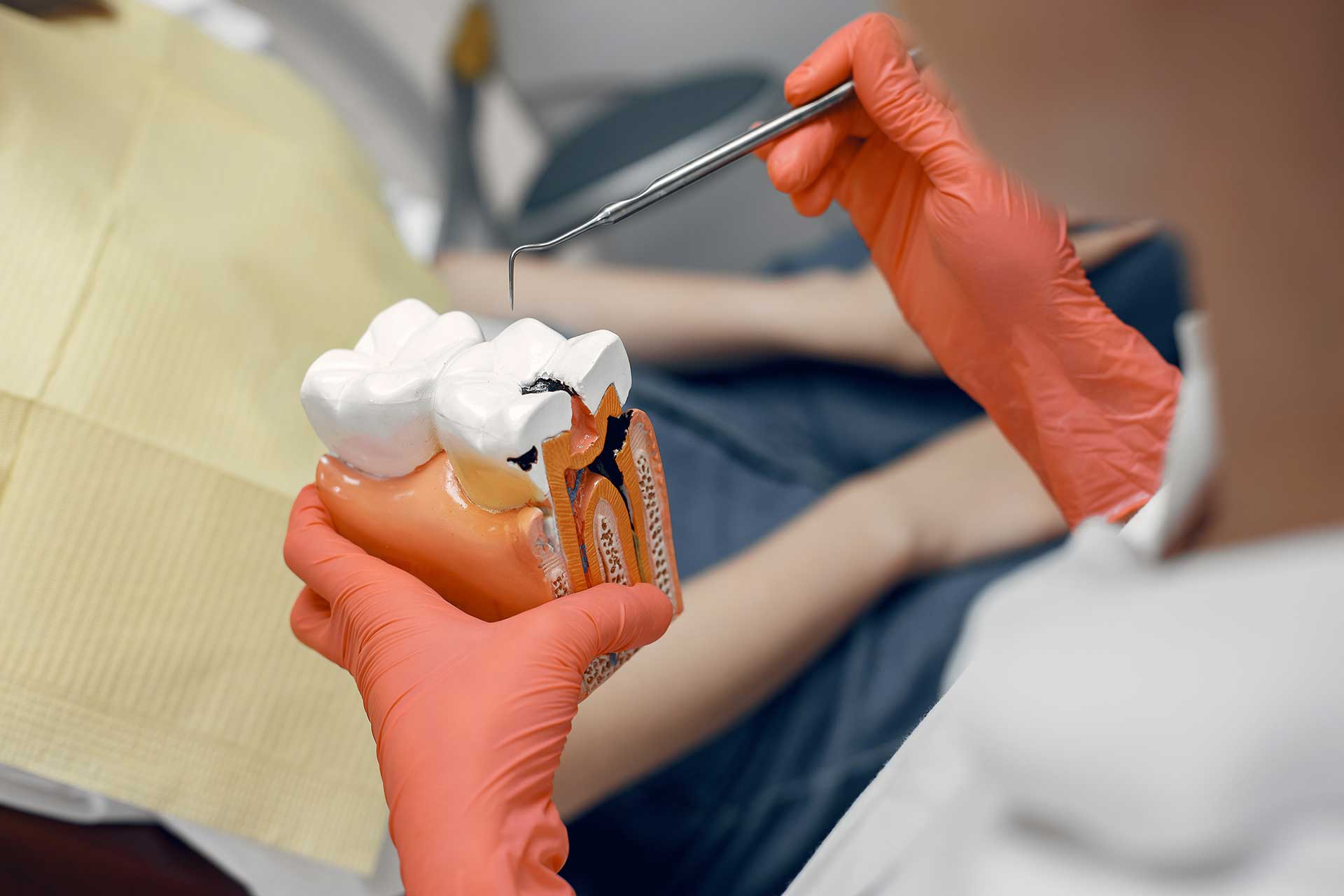 Lifespan and Care of Dental Fillings