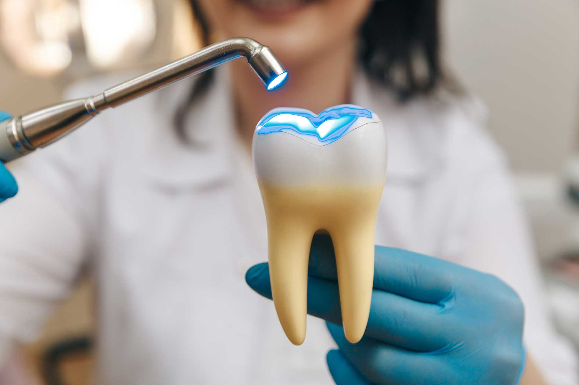Types and Applications of Dental Fillings