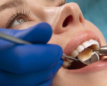 Caring for Your Dental Filling: Essential Tips for Post-Treatment Care