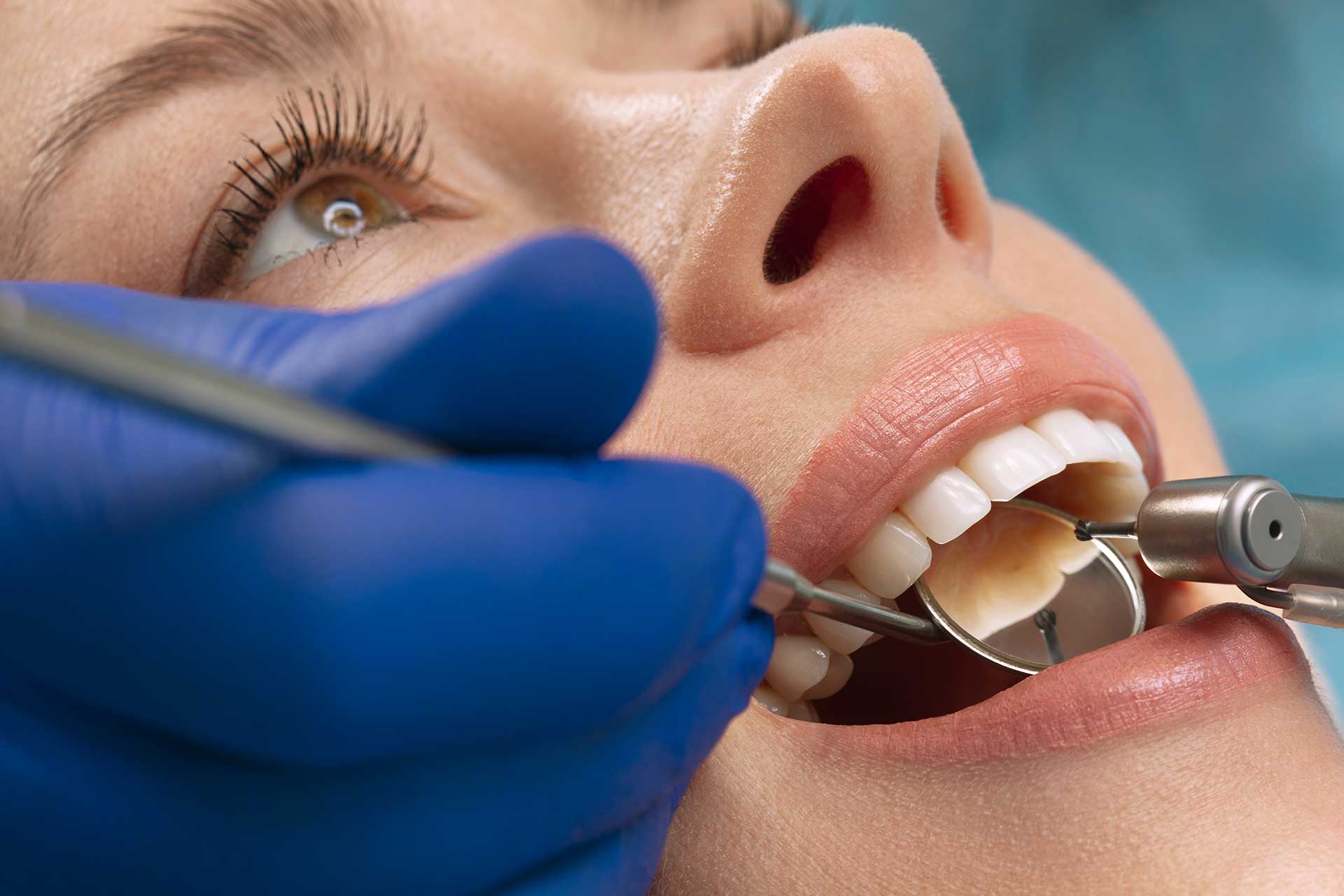 Caring for Your Dental Filling: Essential Tips for Post-Treatment Care
