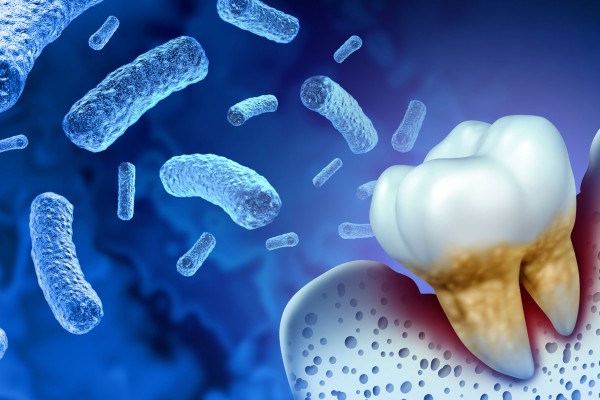 Diş Enfeksiyonu Belirtileri ve Tedavileri