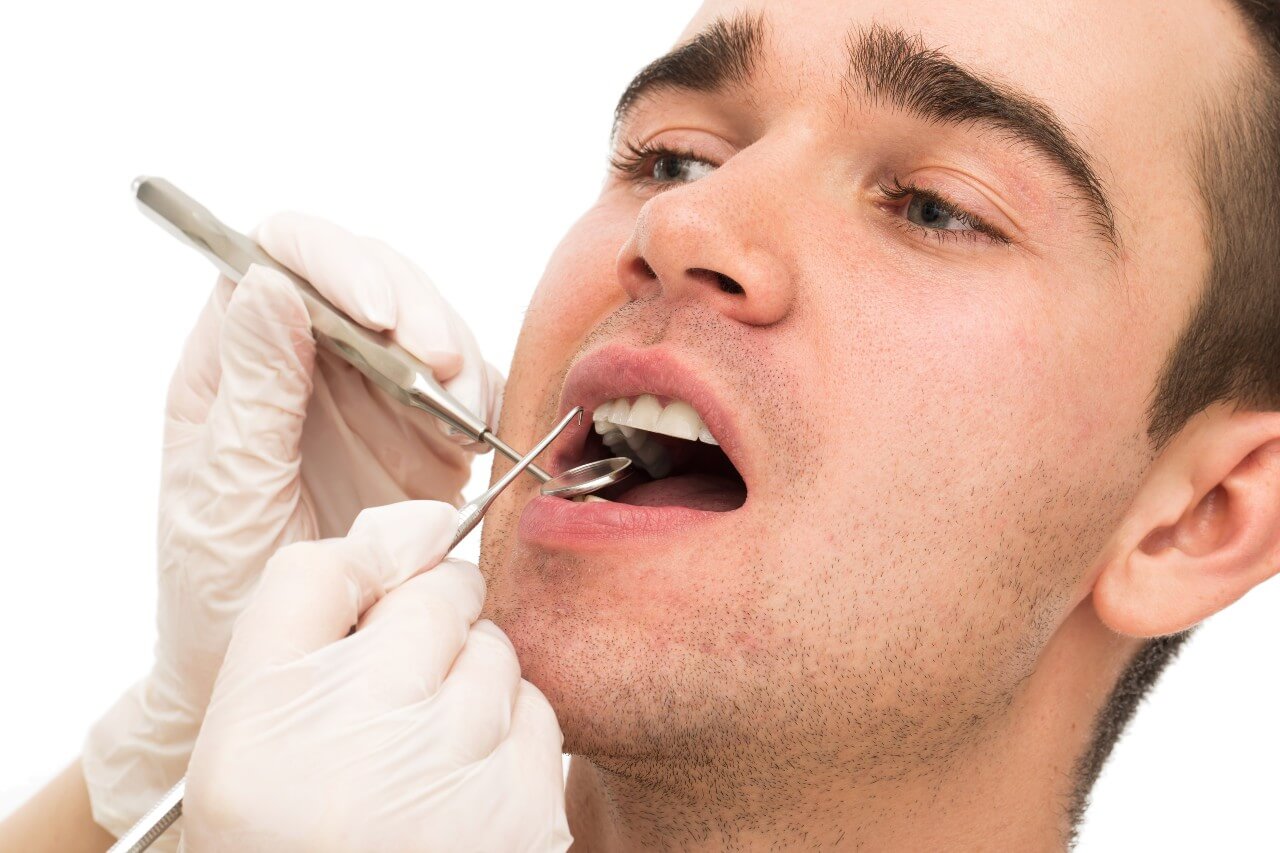 Gum Recession: Causes and Treatment Options