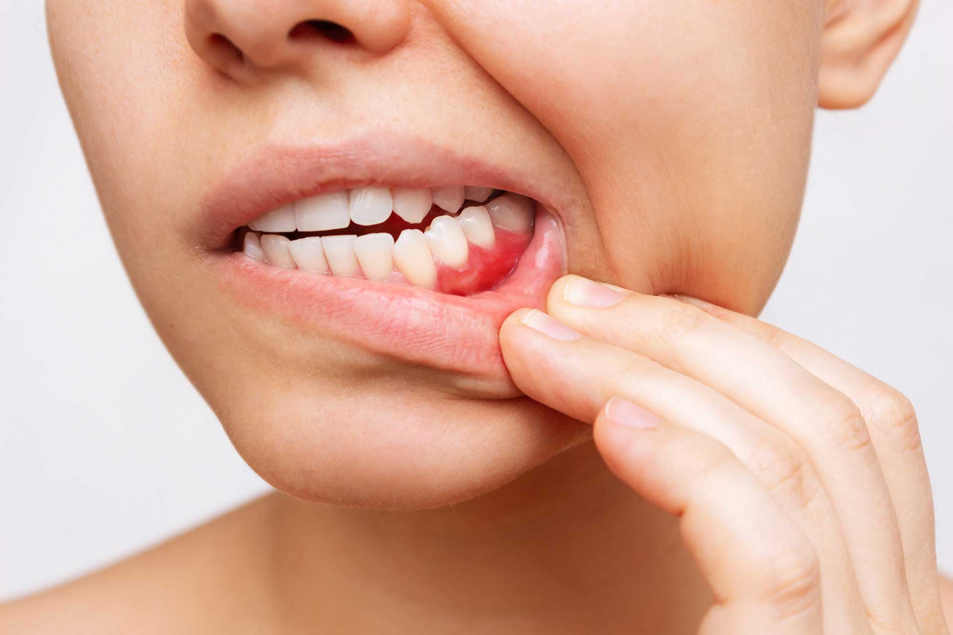 What Is the Connection Between Gum Diseases and Heart Health?