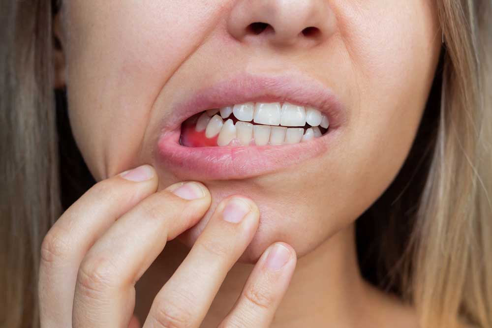 Problems Caused By Gums Diseases 
