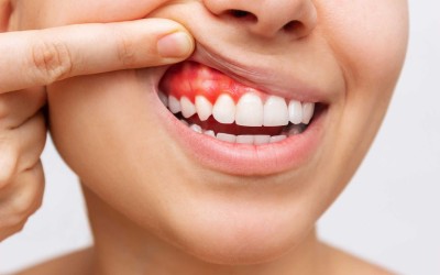 What are the Factors Damaging Gum Health?