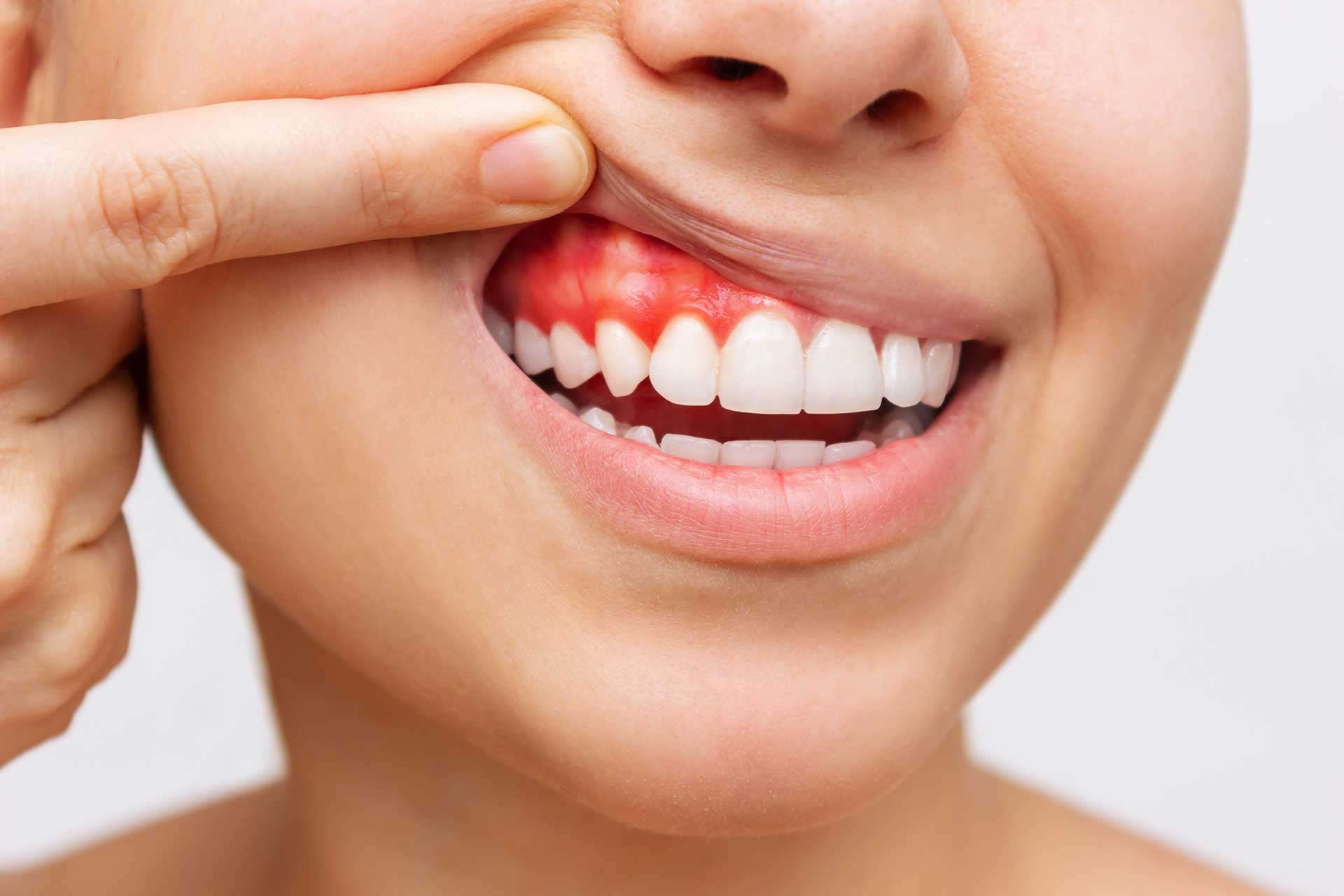What are the Factors Damaging Gum Health?