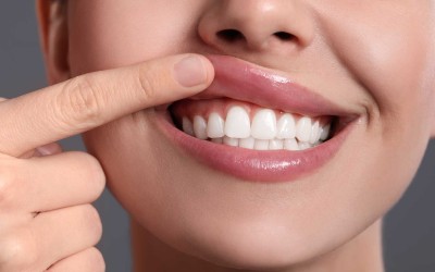 Diş Eti Sağlığını Korumanın Önemi