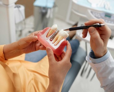 Dental Implants - Costs and Perks