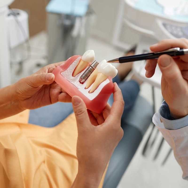 Dental Implants - Costs and Perks