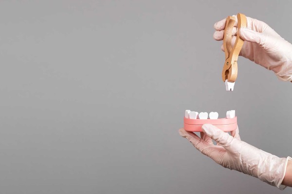 Diş Kaybını Önlemenin Yolları: Periodontit ve Gingivit Nedir?