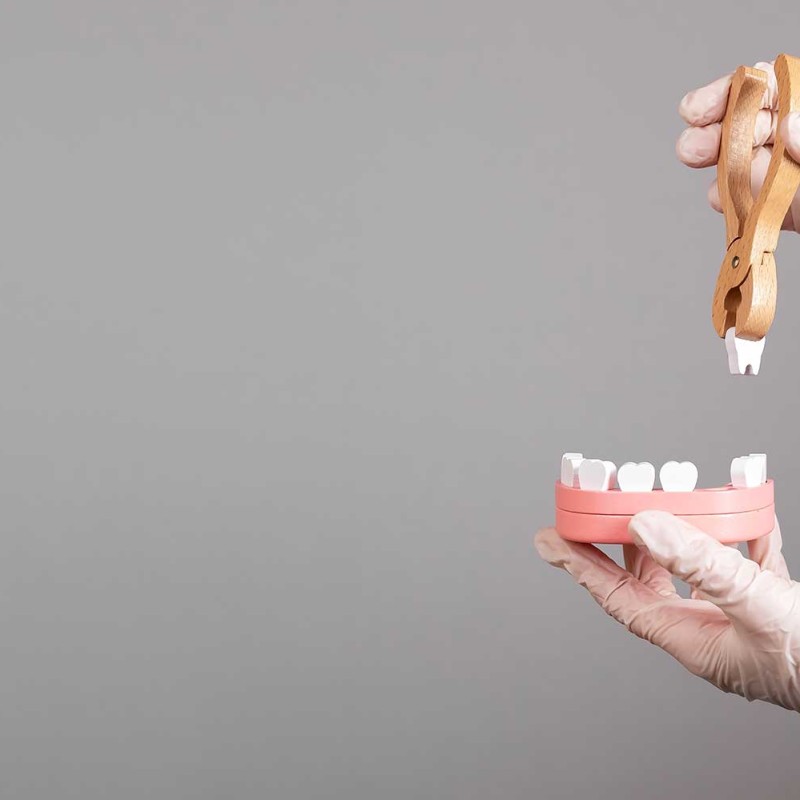Ways to Prevent Tooth Loss Due to Periodontitis and Gingivitis