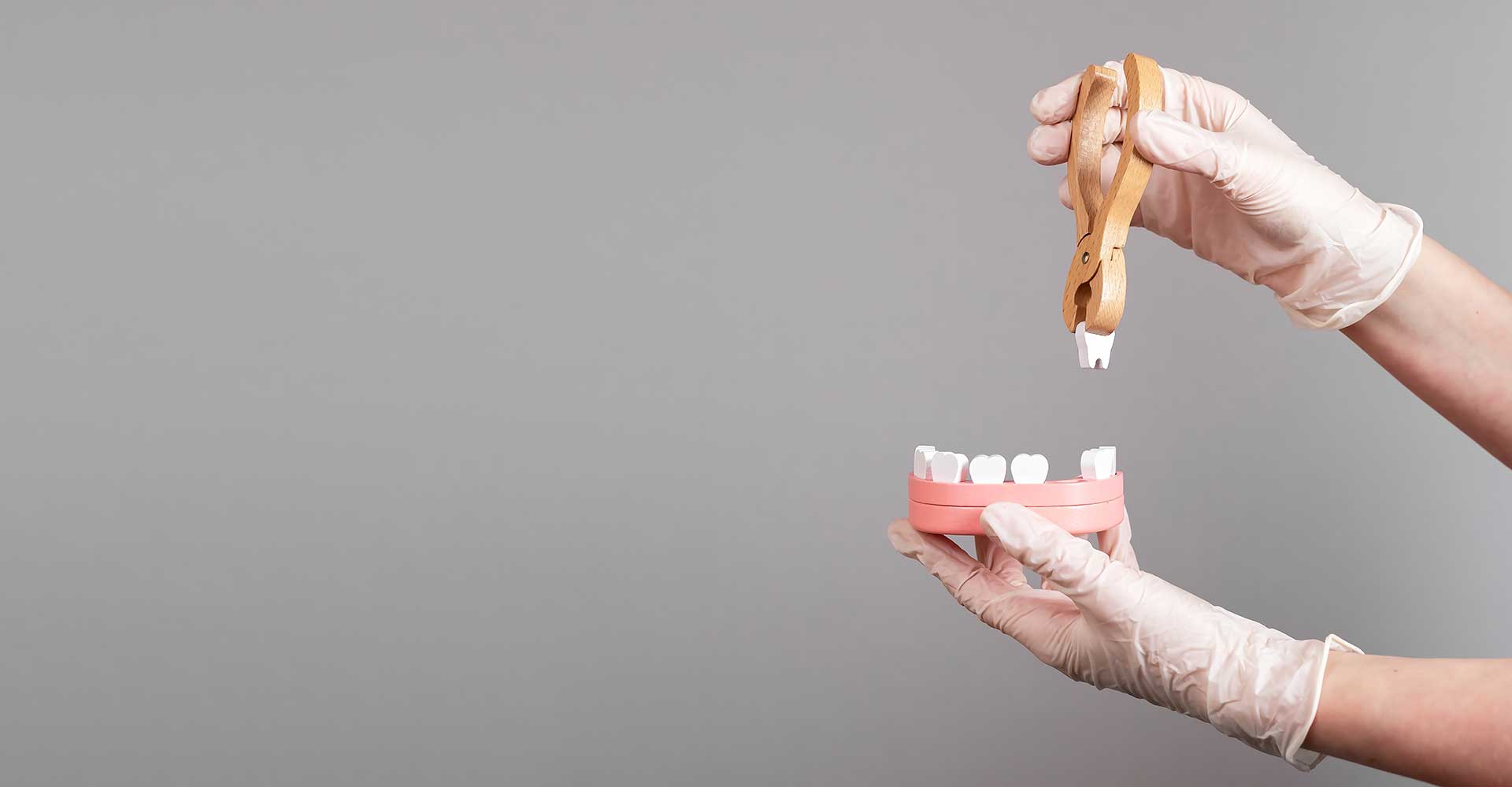 Ways to Prevent Tooth Loss Due to Periodontitis and Gingivitis
