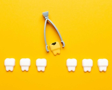 The Effects of Tooth Loss and Restorative Options