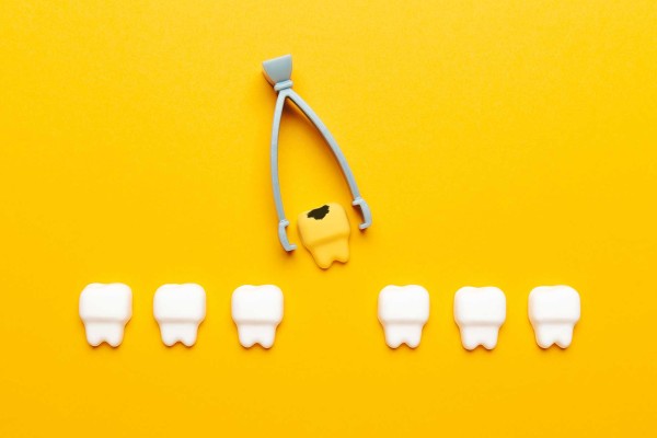 Diş Kaybının Etkileri ve Restoratif Seçenekler