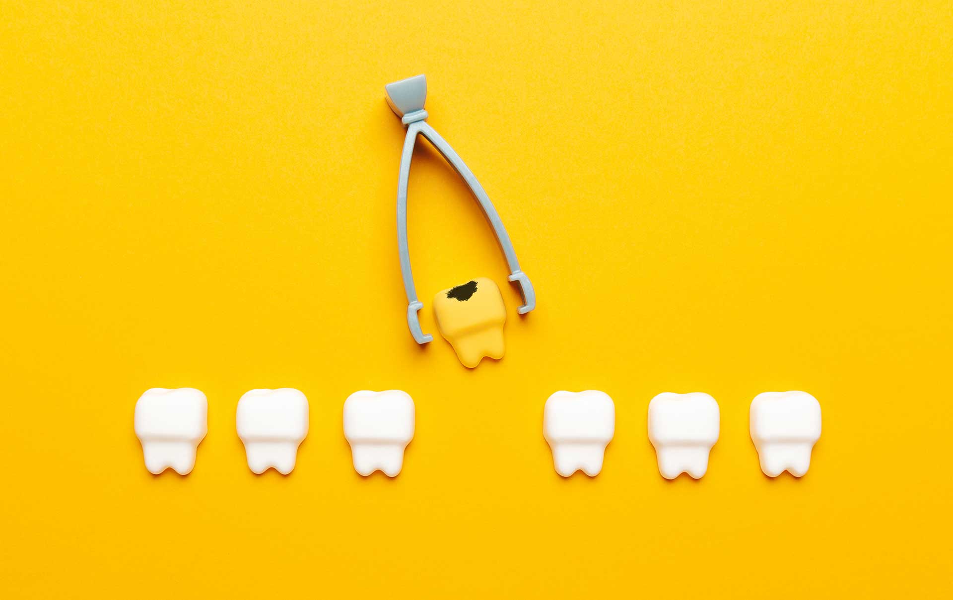 Diş Kaybının Etkileri ve Restoratif Seçenekler