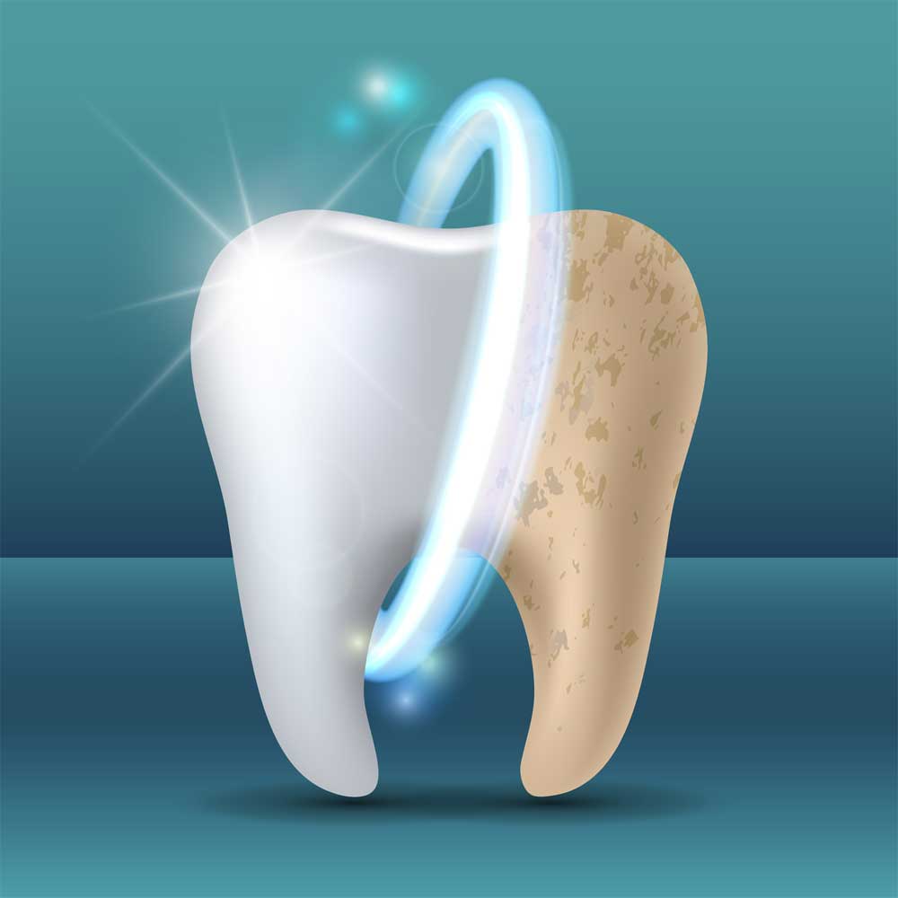 Causes And Solutions Of Tooth Stain 