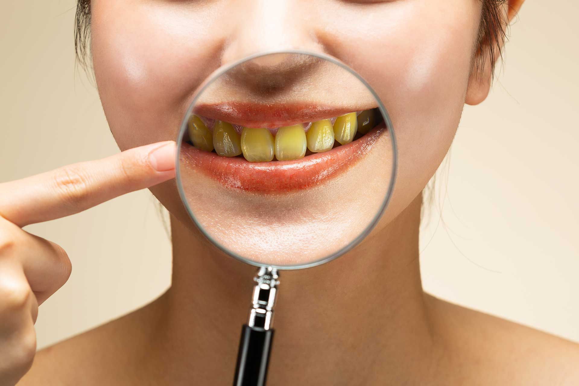 Preventing Tooth Yellowing: Essential Information