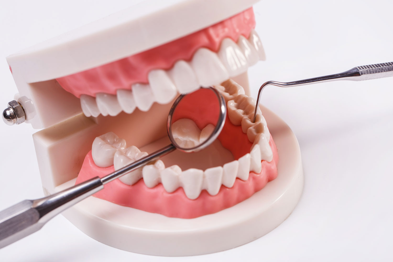 What Are Dental Prostheses? How Is It Treated?