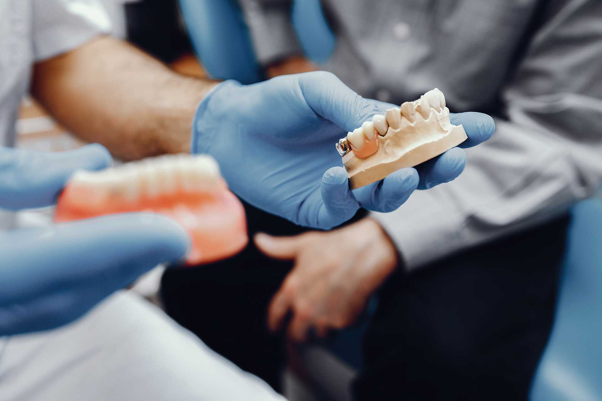 Dental Prostheses: Types, Application, and Essential Care