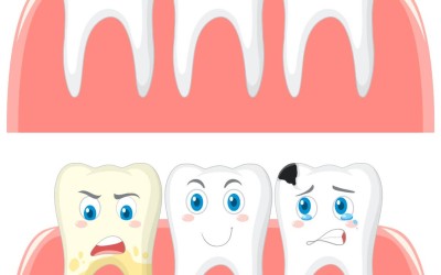 Diş Renklenmesi: Nedenleri ve Çözümleri