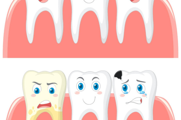 Diş Renklenmesi: Nedenleri ve Çözümleri