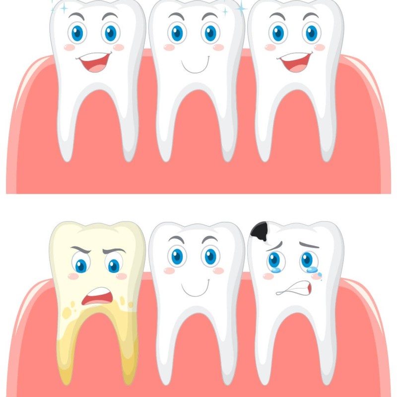 Tooth Discoloration: Causes and Solutions