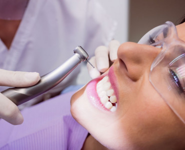 What Should We Consider After Teeth Scaling?