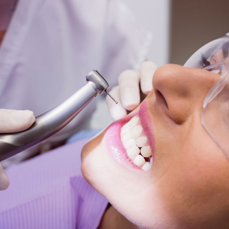 Diş Taşı Temizliği Sonrası Nelere Dikkat Edilmelidir?