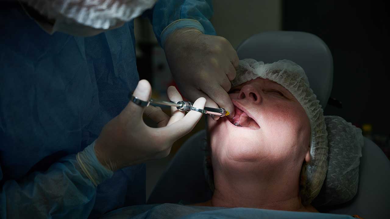 sedation