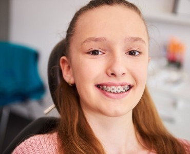 Things to Consider When Using Braces
