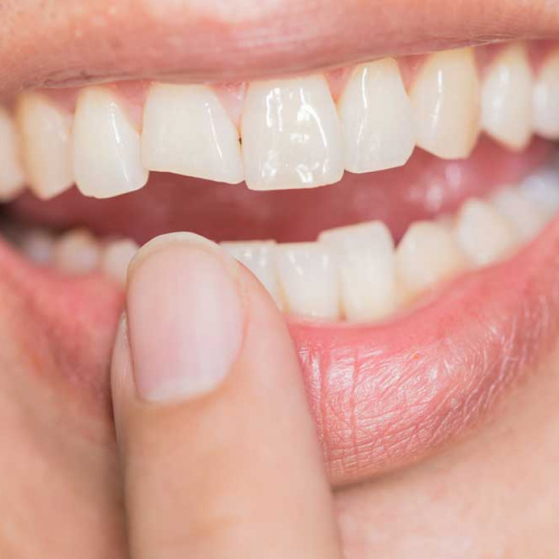 What Is Dental Trauma? What Are The Types Of Dental Trauma? 