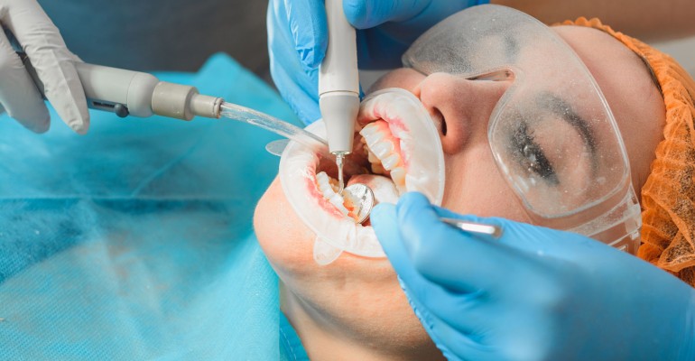 Teeth Cleaning (Detertrage)
