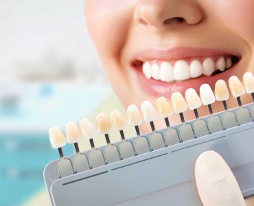 What is Aesthetic Dentistry? What Are Its Applications?