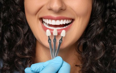 Estetik Diş Kaplamaları: Faydaları ve Türleri