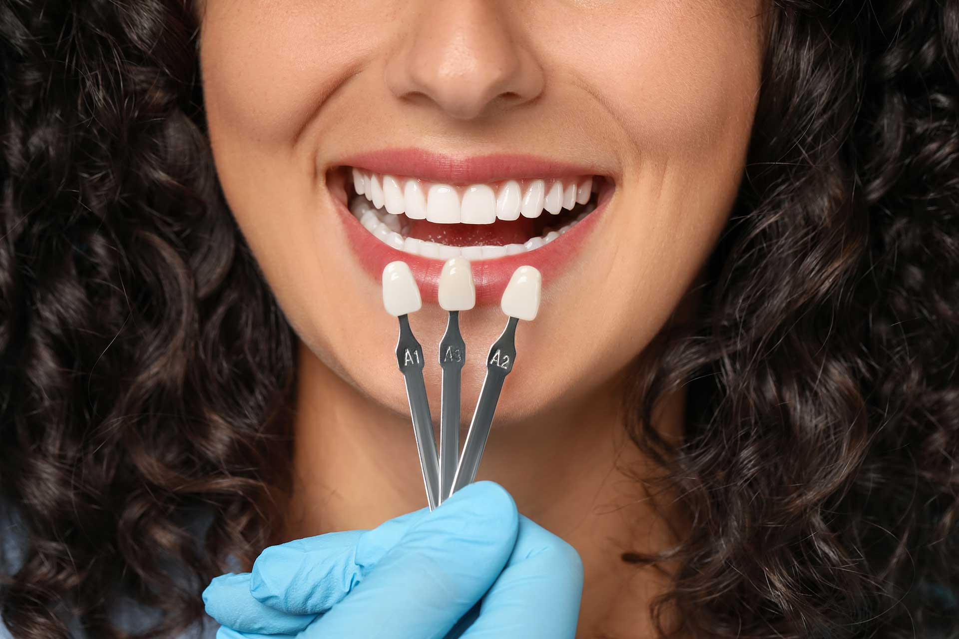 Aesthetic Dental Veneers: Benefits and Types