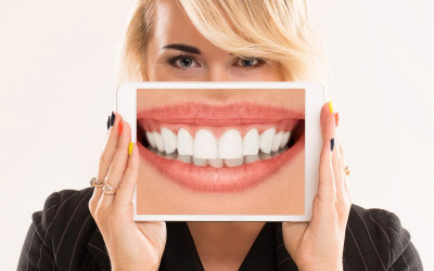 Estetik Gülüş Tasarımı Öncesinde Dikkat Edilmesi Gerekenler