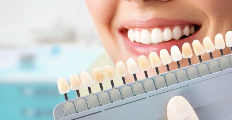 Aesthetic Cosmetic Dentistry