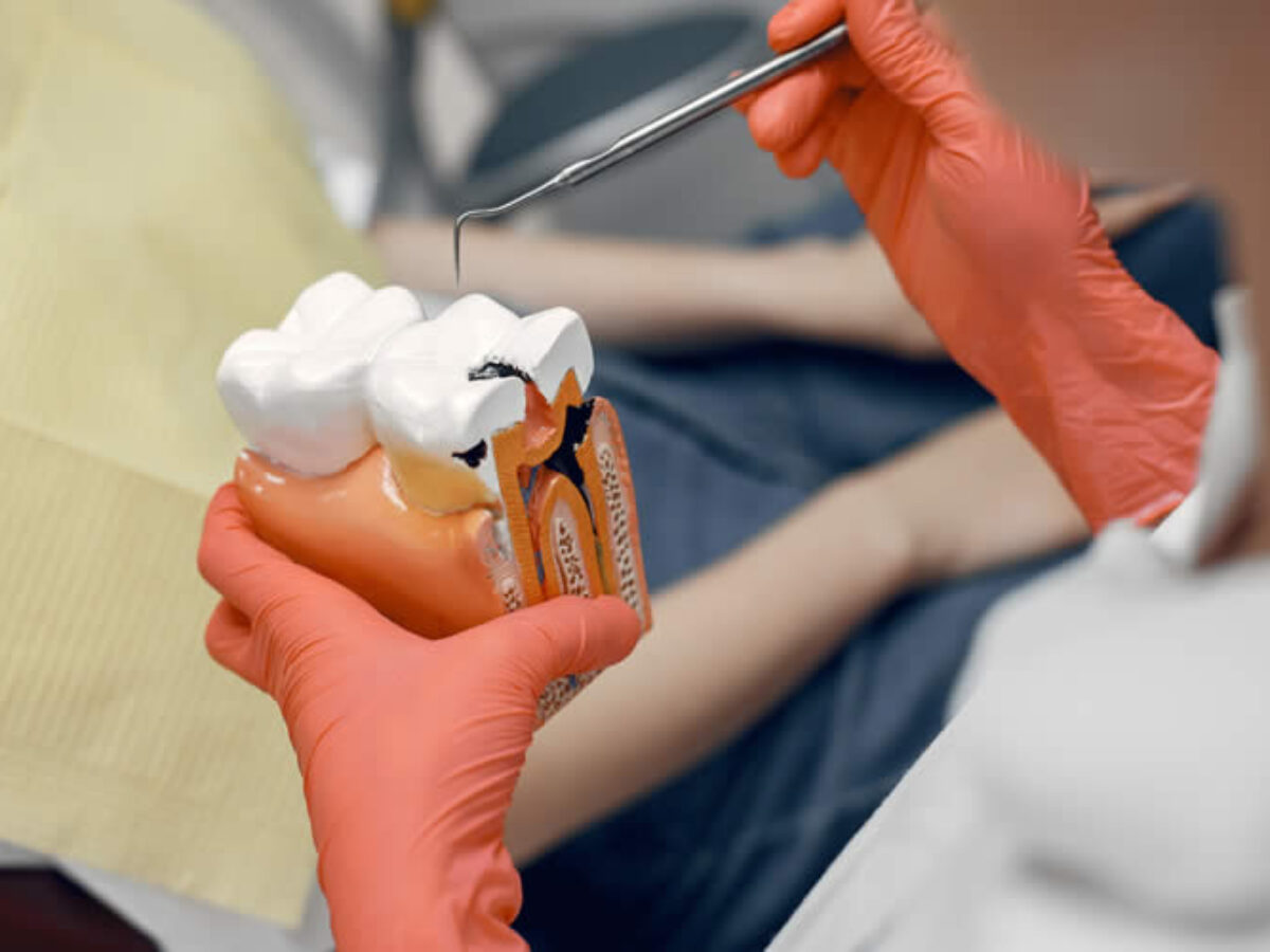 3 Easy Ways To Make dental laminates Faster